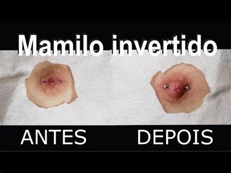 bico invertido fotos|Mamilo Invertido